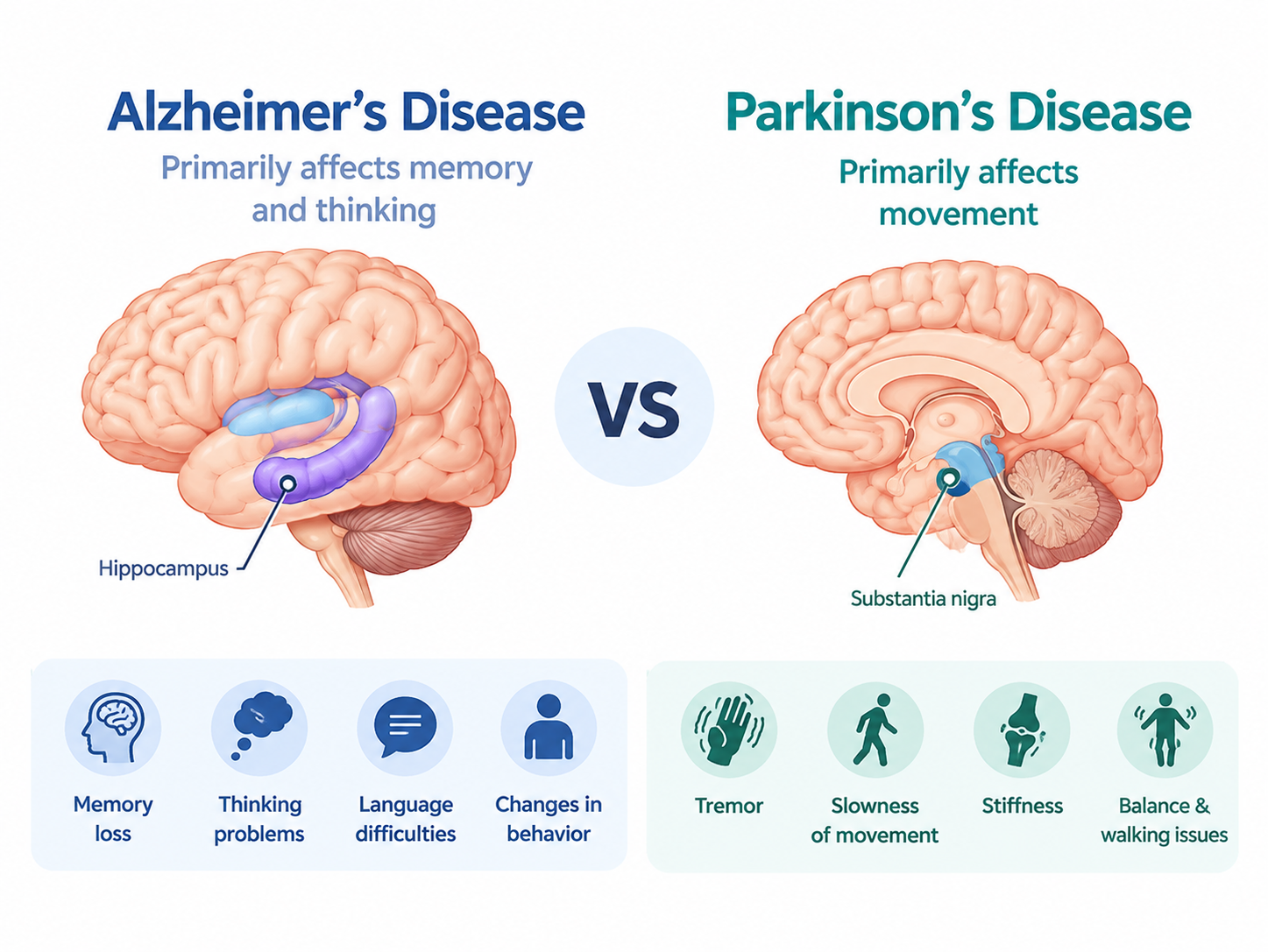 Alzheimer’s Disease and Parkinson’s Disease: 20 Major Differences